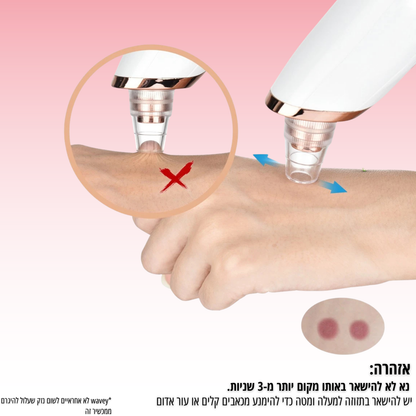 מכשיר להסרת שחורים - PureSkinPro™